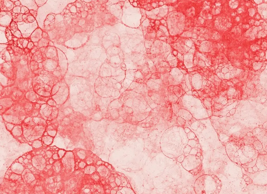 Что означает пониженное содержание лейкоцитов в крови