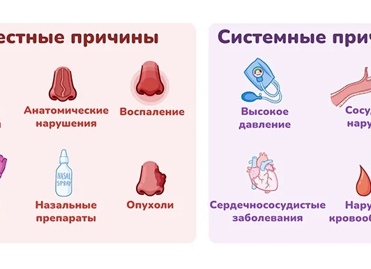 Кровь из носа у взрослого: причины, как остановить кровотечение Кровь из носа у взрослого: причины, как остановить кровотечение