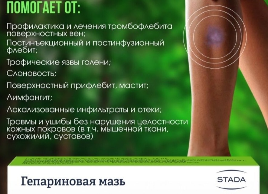 Какие мази эффективно помогают от отеков на ногах