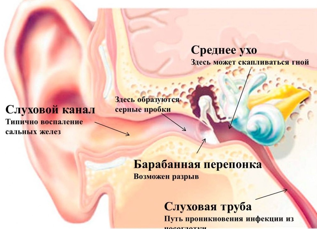 Что делать, если заложило уши: возможные причины и варианты действий