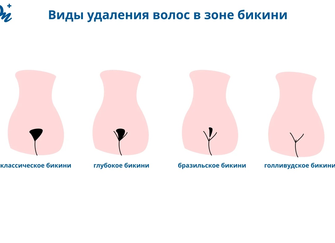 Как правильно брить зону бикини без раздражения Как правильно брить зону бикини без раздражения