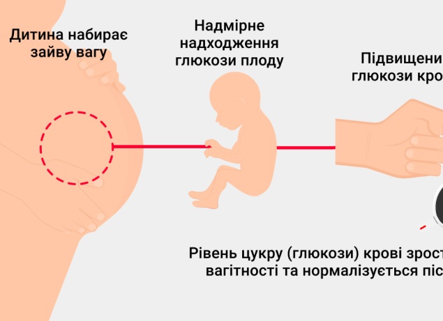 Причины и симптомы гестационного сахарного диабета при беременности Причины и симптомы гестационного сахарного диабета при беременности