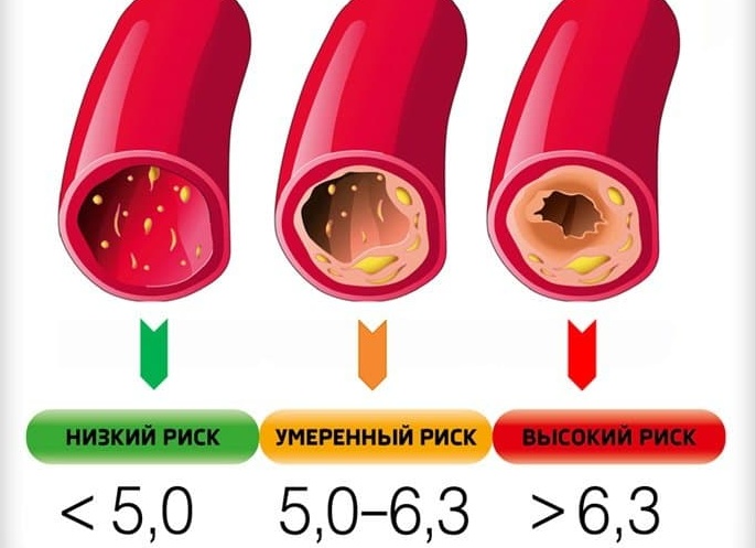 От чего повышается холестерин и как исправить ситуацию?