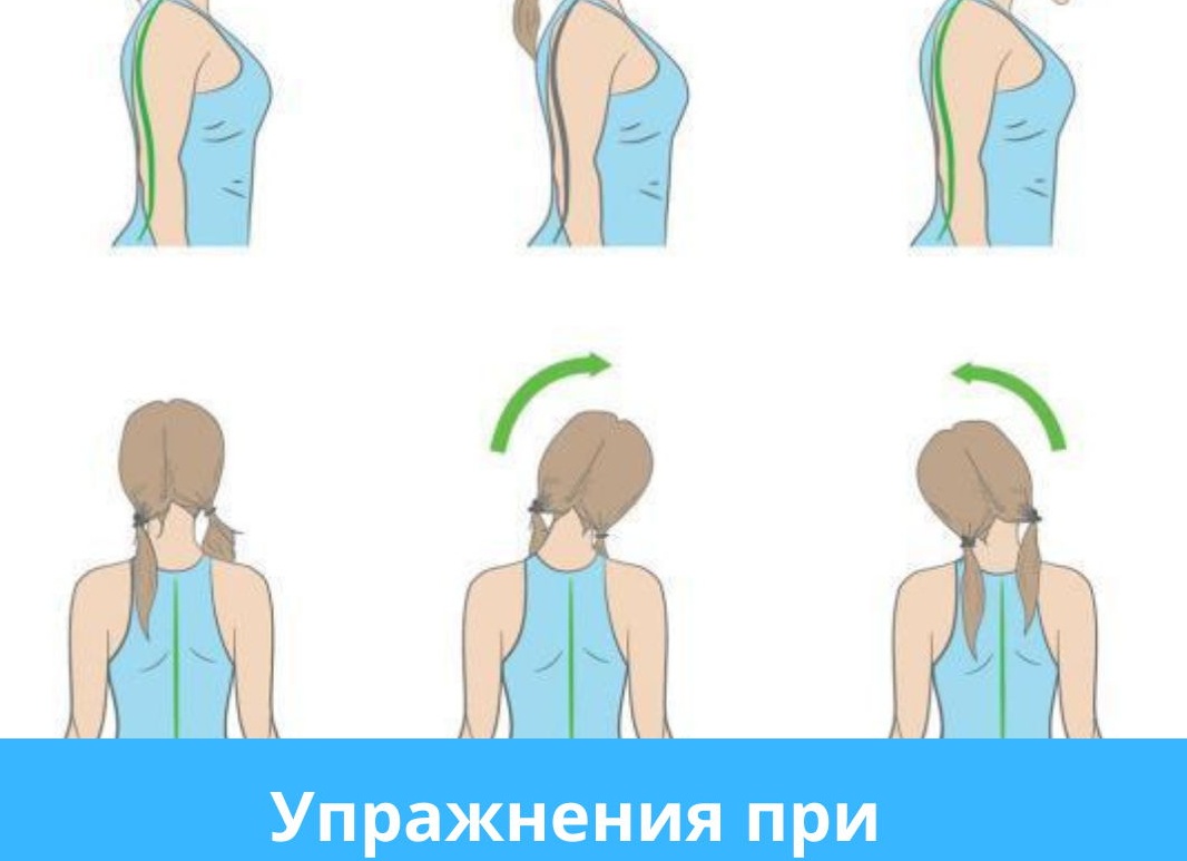 Простые упражнения при шейном остеохондрозе на каждый день Простые упражнения при шейном остеохондрозе на каждый день