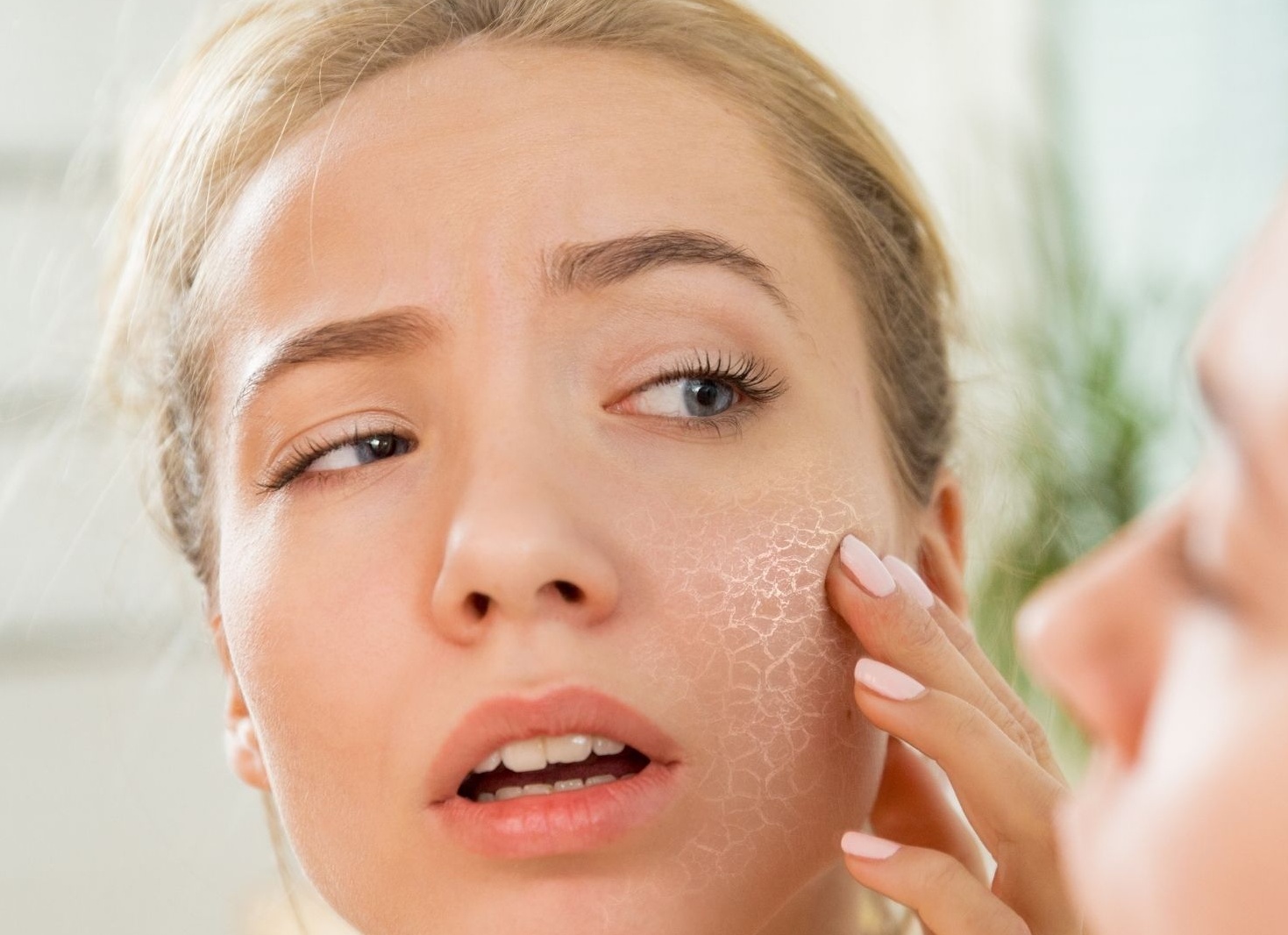 Что делать, если шелушится кожа на лице Что делать, если шелушится кожа на лице