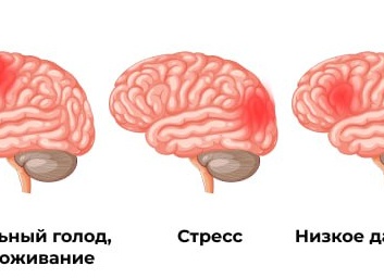 Причины появления пульсирующей боли в голове